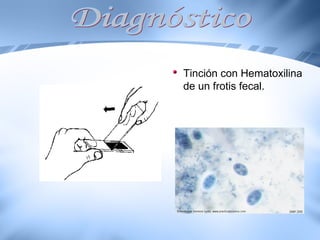 Diagnóstico Tinción con Hematoxilina de un frotis fecal.  