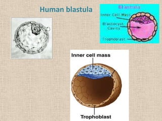 Human blastula
 
