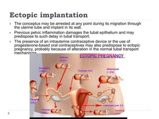 Ectopic implantation
 The conceptus may be arrested at any point during its migration through
the uterine tube and implant in its wall.
 Previous pelvic inflammation damages the tubal epithelium and may
predispose to such delay in tubal transport.
 The presence of an intrauterine contraceptive device or the use of
progesterone-based oral contraceptives may also predispose to ectopic
pregnancy, probably because of alteration in the normal tubal transport
mechanisms.
 