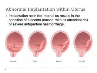 Abnormal Implantation within Uterus
 Implantation near the internal os results in the
condition of placenta praevia, with its attendant risk
of severe antepartum haemorrhage.
 