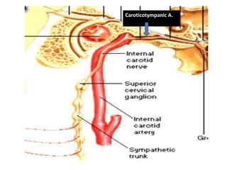Caroticotympanic A.
 