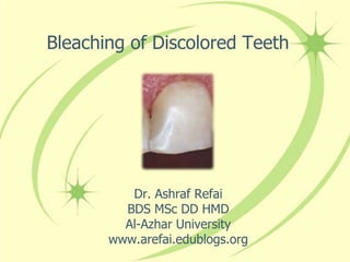 Bleaching of Discolored Teeth




          Dr. Ashraf Refai
         BDS MSc DD HMD
         Al-Azhar University
       www.arefai.edublogs.org
 