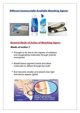 Different Commercially Available Bleaching Agents :
General Mode of Action of Bleaching Agent :
Mode of action-1
 