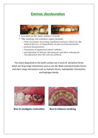 Extrinsic discolouration
The stains deposited on the tooth surface are a result of attractive forces
which are long range interactions such as van der Walls and electrostatic forces
and short range interactions such as hydratin forces, hydrophobic interactions,
and hydrogen bonds.
Due to amalgam restoration Due to tobacco smoking
 