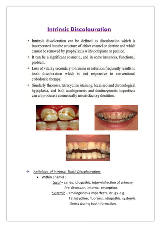 Intrinsic Discolouration
 Aetiology of Intrinsic Tooth Discolouration-
 Within Enamel :
Local – caries, idiopathic, injury/infection of primary
Pre-decessor, internal resorption.
Systemic – amelogenesis imperfecta, drugs e.g.
Tetracycline, fluorosis, idiopathic, systemic
illness during tooth formation.
 