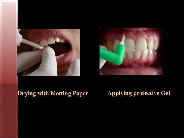 Bleaching