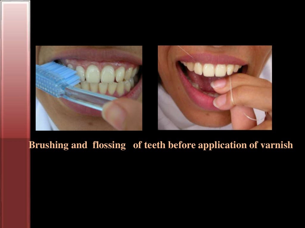 Bleaching