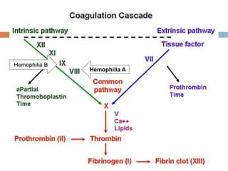 Hemophilia A
Hemophilia B
 