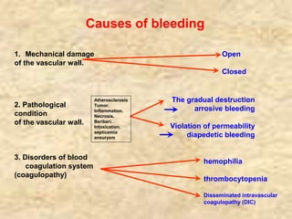 Bleeding. blood loss. bleeding compensation in eliminating the ...