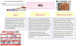 RED
Rest
In all cases, the less movement the
wound undergoes, the easier the
healing process will be, so rest is
advised. Rest will also reduce the
pulse rate, thus the severity of the
bleeding, especially in the case of
arterial bleeding
Elevation
Direct pressure is usually enough to
stop most minor bleeds, but for larger
bleeds, it may be necessary to elevate
the wound above the level of the heart
(whilst maintaining direct pressure the
whole time). This decreases the blood
flow to the affected area, slowing the
blood flow, and assisting clotting.
Elevation only works on the
peripheries of the body (limbs and
head) and is not appropriate for body
wounds.
Direct pressure
The most important of these three is
direct pressure. This is simply
placing pressure on the wound in
order to stem the flow of blood. This
is best done using a dressing, such as
a sterile gauze pad (although in an
emergency, any material is suitable).
If the blood starts to come through
the dressing you are using, add
additional dressings to the top, to a
maximum of three.
 