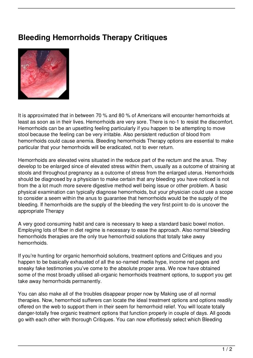 Bleeding Hemorrhoids Therapy Critiques
