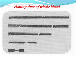clotting time of whole blood
 