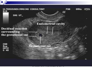 Dr.Basma ,FM,SCU,2012-2013
 