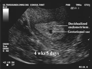 Dr.Basma ,FM,SCU,2012-2013
 