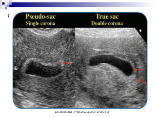 Dr.Basma ,FM,SCU,2012-2013
 