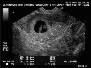 Dr.Basma ,FM,SCU,2012-2013
 