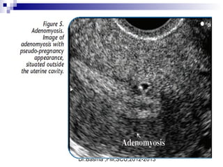 Dr.Basma ,FM,SCU,2012-2013
 