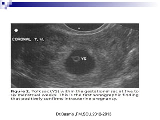 Dr.Basma ,FM,SCU,2012-2013
 