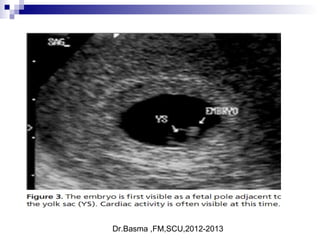 Dr.Basma ,FM,SCU,2012-2013
 