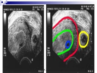 Dr.Basma ,FM,SCU,2012-2013
 