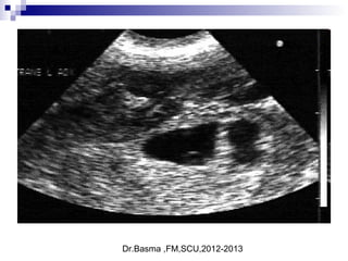 Dr.Basma ,FM,SCU,2012-2013
 