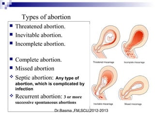 Dr.Basma ,FM,SCU,2012-2013
Types of abortion
 Threatened abortion.
 Inevitable abortion.
 Incomplete abortion.
 Complete abortion.
 Missed abortion
 Septic abortion: Any type of
abortion, which is complicated by
infection
 Recurrent abortion: 3 or more
successive spontaneous abortions
 