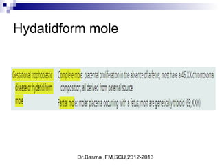 Dr.Basma ,FM,SCU,2012-2013
Hydatidform mole
 