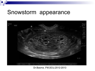 Dr.Basma ,FM,SCU,2012-2013
Snowstorm appearance
 