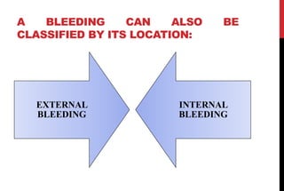 A BLEEDING CAN ALSO BE
CLASSIFIED BY ITS LOCATION:
EXTERNAL
BLEEDING
INTERNAL
BLEEDING
 
