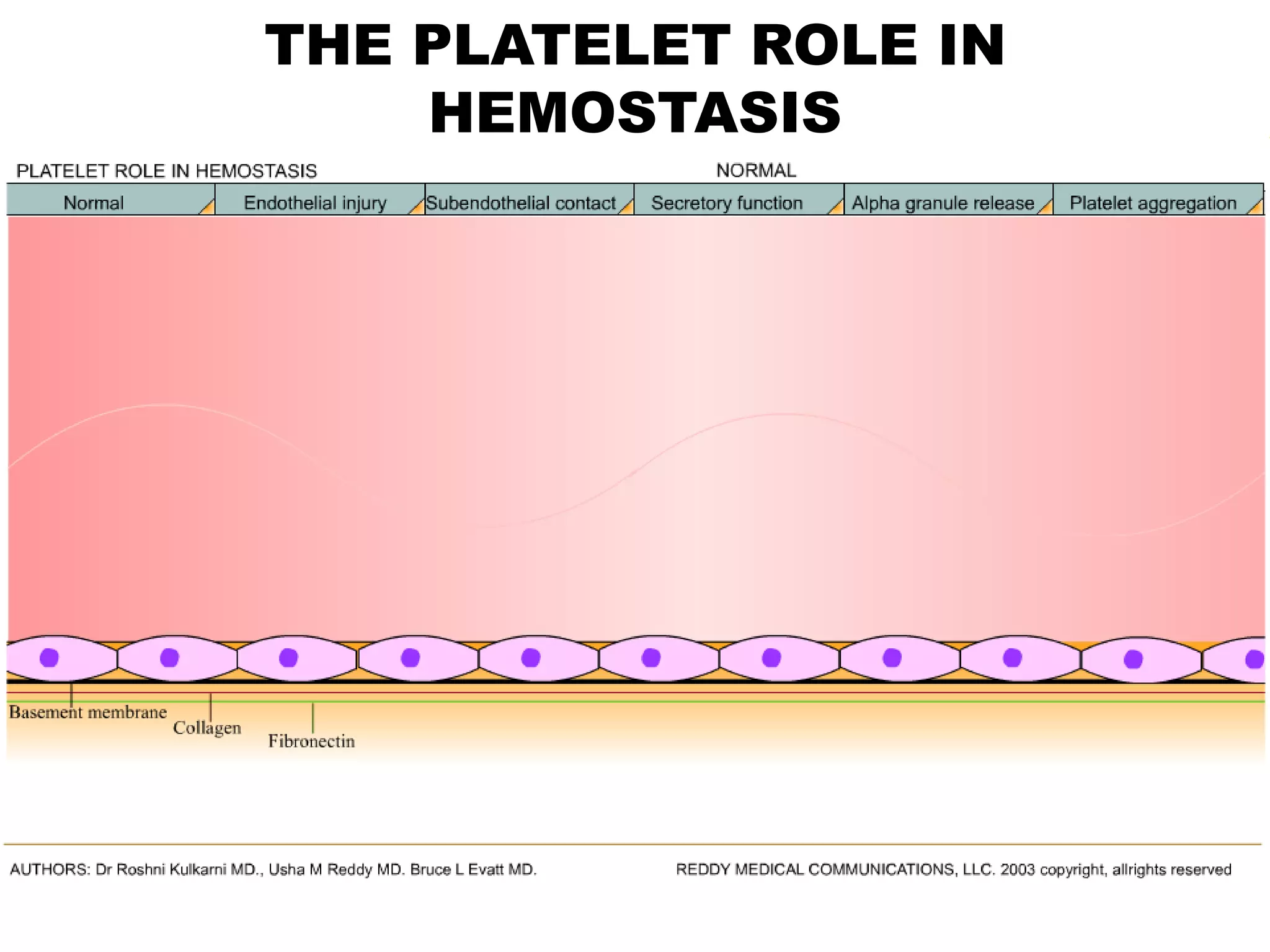 Bleeding and coagulation disorders hemostasis | PPTX