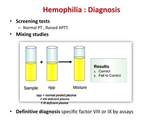 Hemophilia : Diagnosis
• Screening tests
– Normal PT , Raised APTT.
• Mixing studies
• Definitive diagnosis specific factor VIII or IX by assays
F VIII deficient plasma
F IX deficient plasma
 