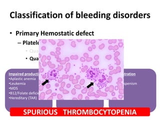 Classification of bleeding disorders
• Primary Hemostatic defect
– Platelet disorder
• Qualitative
• Quantitative (Thrombocytopenia)
Impaired production
•Aplastic anemia
•Leukemia
•MDS
•B12/Folate deficiency
•Hereditary (TAR)
Increased destruction
•ITP
•SLE
•Thrombotic
microangiopathy (HUS)
Sequestration
•Hyperspenism
SPURIOUS THROMBOCYTOPENIA
 