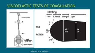 VISCOELASTIC TESTS OF COAGULATION
Montalto et al, JOH 2002
 
