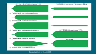 Davis et al, Ann of Hepat 2018
 