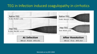 TEG in Infection induced coagulopathy in cirrhotics
Montalto et al,JOH 2002
 