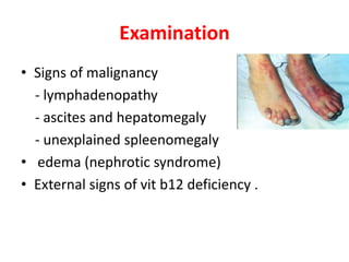 Examination
• Signs of malignancy
- lymphadenopathy
- ascites and hepatomegaly
- unexplained spleenomegaly
• edema (nephrotic syndrome)
• External signs of vit b12 deficiency .
 