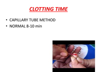 CLOTTING TIME
• CAPILLARY TUBE METHOD
• NORMAL 8-10 min
 