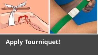 Apply Tourniquet!
 