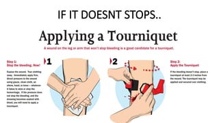 IF IT DOESNT STOPS..
 