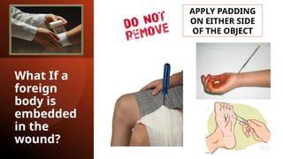 What If a
foreign
body is
embedded
in the
wound?
APPLY PADDING
ON EITHER SIDE
OF THE OBJECT
 