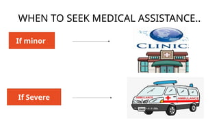 WHEN TO SEEK MEDICAL ASSISTANCE..
If minor
If Severe
 