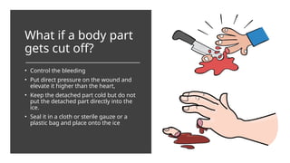 What if a body part
gets cut off?
• Control the bleeding
• Put direct pressure on the wound and
elevate it higher than the heart,
• Keep the detached part cold but do not
put the detached part directly into the
ice.
• Seal it in a cloth or sterile gauze or a
plastic bag and place onto the ice
 