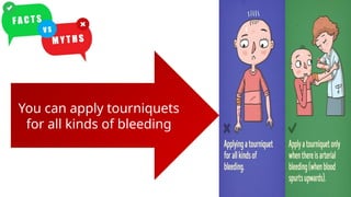 You can apply tourniquets
for all kinds of bleeding
You can apply tourniquets
for all kinds of bleeding
 