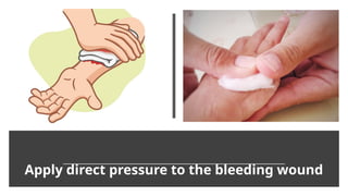 Apply direct pressure to the bleeding wound
 