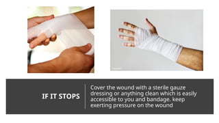 IF IT STOPS
Cover the wound with a sterile gauze
dressing or anything clean which is easily
accessible to you and bandage. keep
exerting pressure on the wound
 