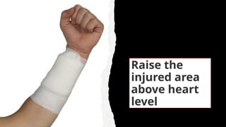 Raise the
injured area
above heart
level
 