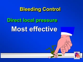 Bleeding control.ppt