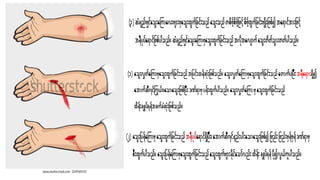 bleeding control PowerPoint Presentation (TCCC).pptx