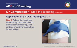 Bleeding Control Basic - Jim Persons | PDF