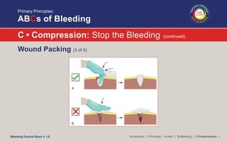 Bleeding Control Basic - Jim Persons | PDF